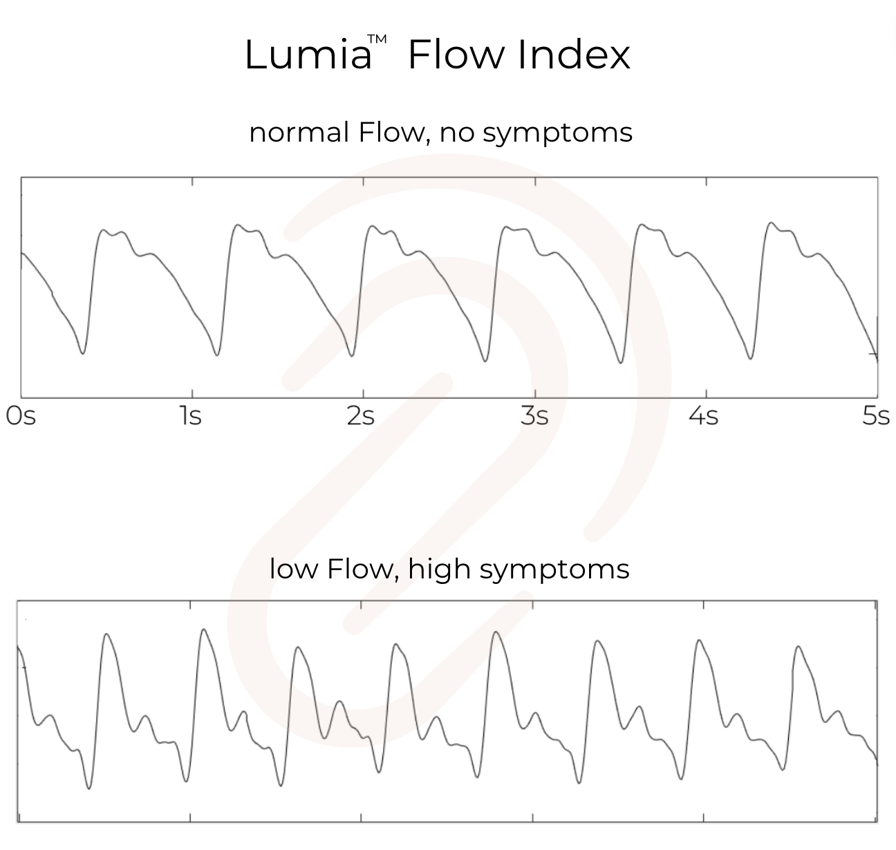 Lumia Flow Index is wave form analysis proxy for CBF Cerebral Blood Flow